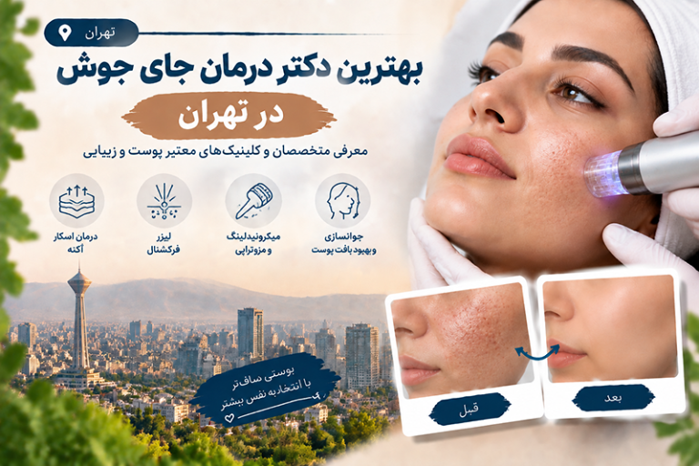 بهترین دکتر درمان جای جوش در تهران؛ معرفی متخصصان درمان اسکار آکنه و بازسازی پوست