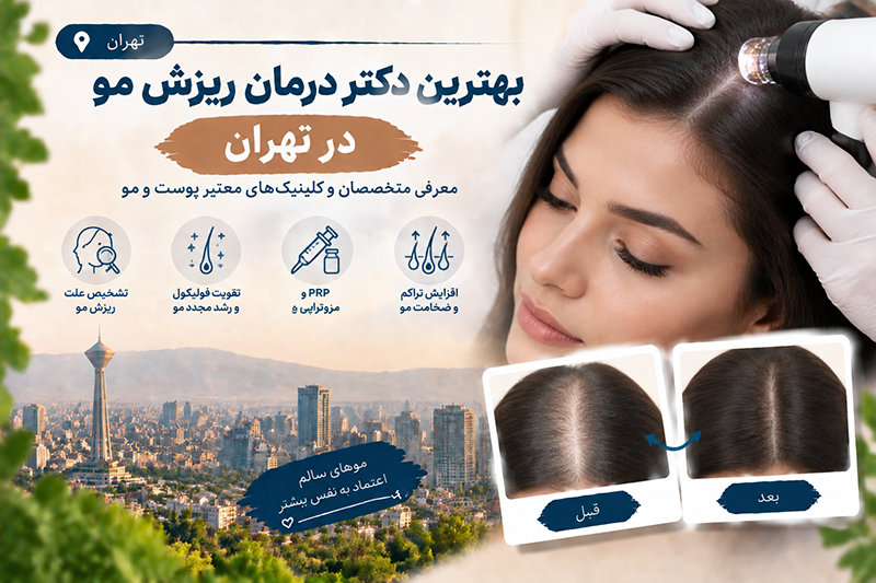 بهترین دکتر درمان ریزش مو در تهران