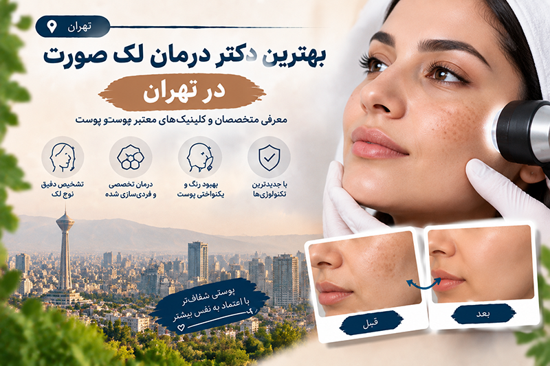 بهترین دکتر درمان لک صورت در تهران
