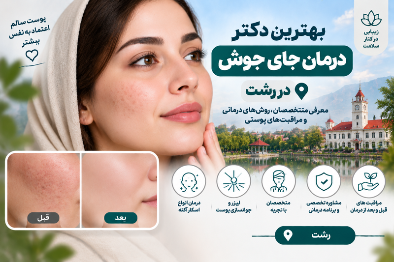 بهترین دکتر درمان جای جوش در رشت؛ معرفی متخصصان درمان اسکار آکنه و بازسازی پوست