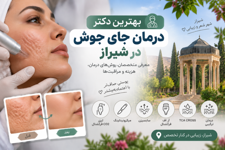 بهترین دکتر آر اف فرکشنال در قم؛ معرفی پزشکان و مراکز جوانسازی و درمان جای جوش