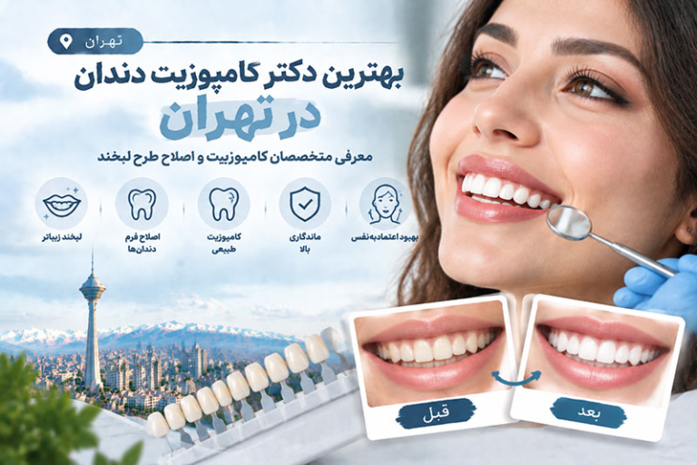 بهترین دکتر کامپوزیت دندان در تهران؛ معرفی متخصصان کامپوزیت و اصلاح طرح لبخند
