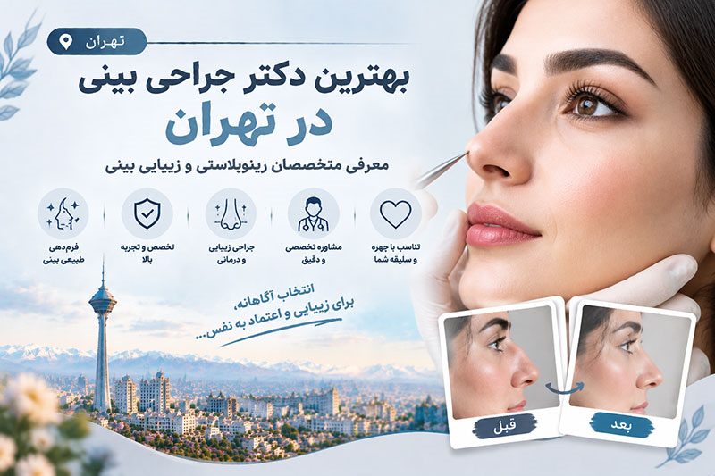 بهترین دکتر جراحی بینی در تهران