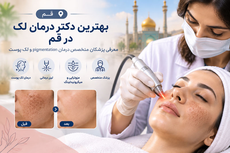 بهترین دکتر درمان لک و pigmentation در قم؛ معرفی پزشکان متخصص درمان لک پوست