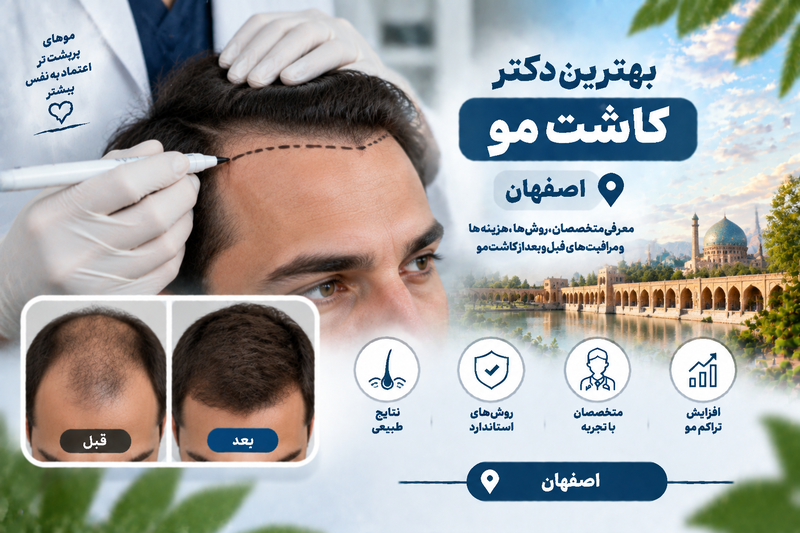 بهترین دکتر کاشت مو در اصفهان؛ معرفی متخصصان کاشت مو و درمان کم‌پشتی مو