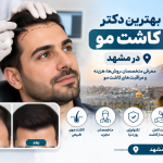 بهترین دکتر کاشت مو در مشهد؛ معرفی متخصصان کاشت موی طبیعی و هزینه آن