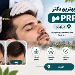 بهترین دکتر PRP مو در تهران؛ معرفی متخصصان، مزایا، هزینه و مراحل درمان