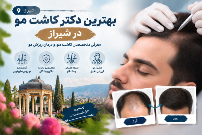 بهترین دکتر کاشت مو در شیراز؛ معرفی متخصصان کاشت مو و درمان ریزش مو