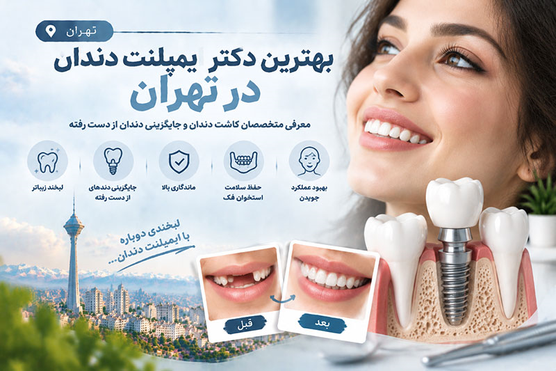 بهترین دکتر ایمپلنت دندان در تهران