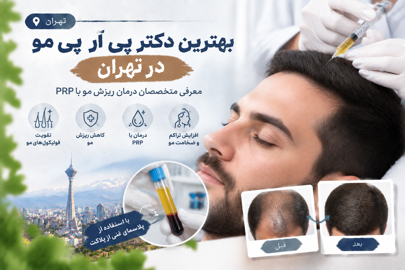 بهترین دکتر پی آر پی مو در تهران