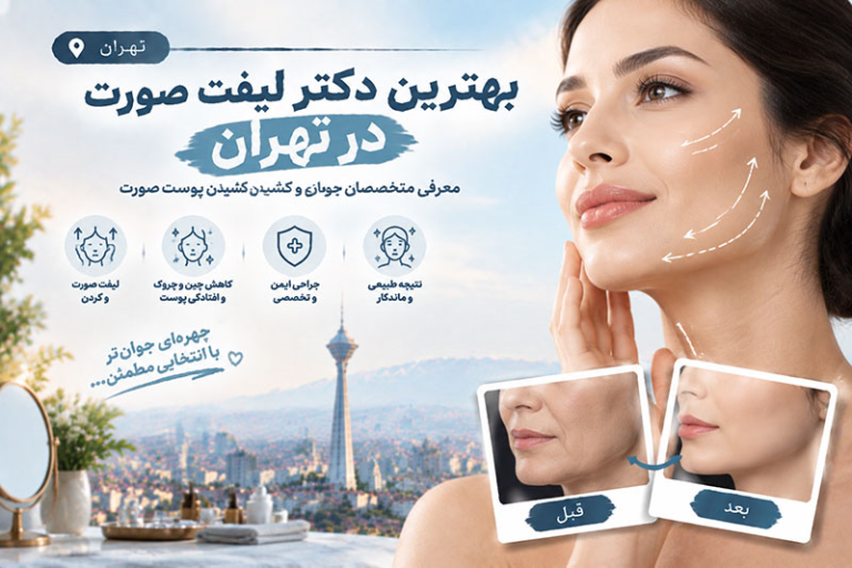 بهترین دکتر لیفت صورت در تهران؛ معرفی متخصصان جوانسازی و کشیدن پوست صورت