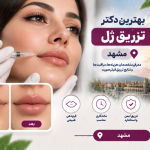 بهترین دکتر تزریق ژل در مشهد؛ معرفی متخصصان فیلر صورت و فرم‌دهی چهره