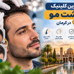 بهترین کلینیک کاشت مو در کرمان؛ معرفی مراکز معتبر کاشت موی طبیعی