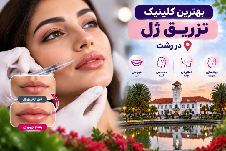 بهترین کلینیک تزریق ژل در رشت؛ معرفی مراکز معتبر فیلر و فرم‌دهی صورت