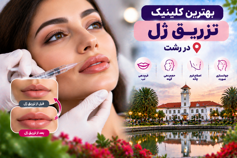 بهترین کلینیک تزریق ژل در رشت؛ معرفی مراکز معتبر فیلر و فرم‌دهی صورت