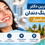 بهترین دکتر بلیچینگ دندان در شیراز؛ معرفی ۵ دندانپزشک با آدرس و شماره تماس