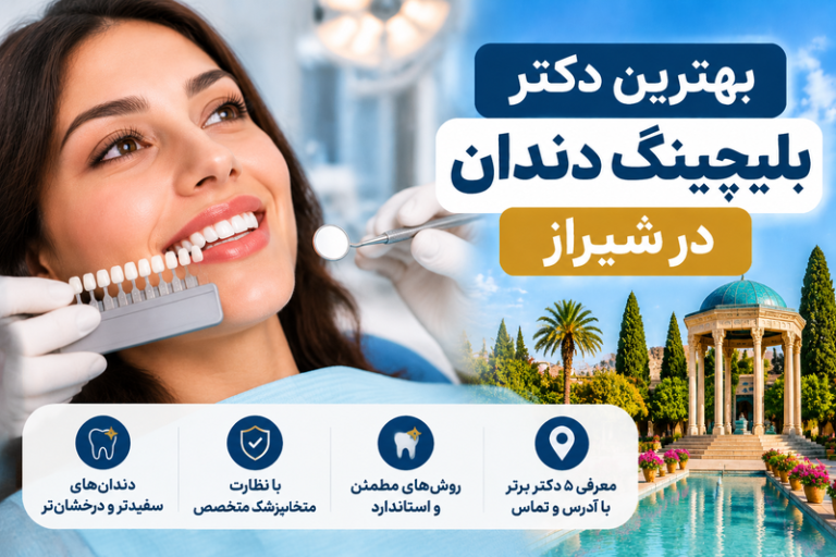 بهترین دکتر بلیچینگ دندان در شیراز؛ معرفی ۵ دندانپزشک با آدرس و شماره تماس