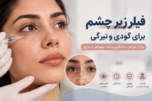 فیلر زیر چشم برای گودی و تیرگی؛ مزایا و عوارض