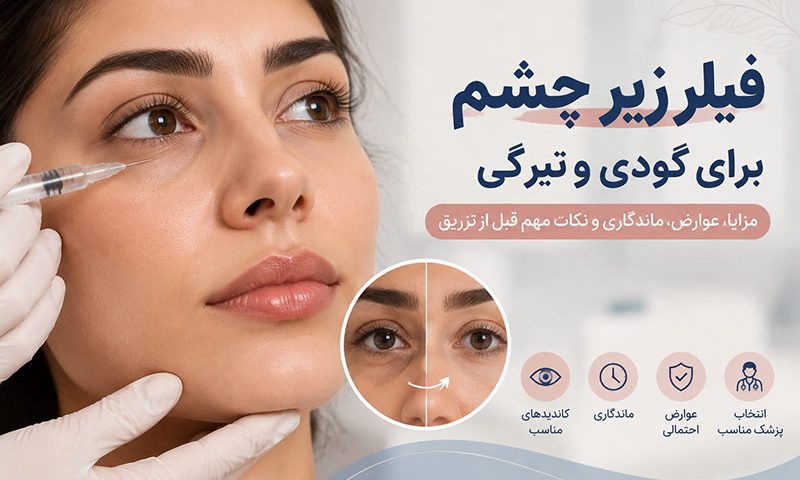 تزریق فیلر زیر چشم برای بهبود گودی و سایه زیر چشم